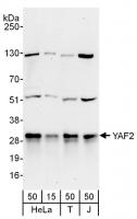Detection of human YAF2 by western blot.