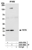 Detection of human YKT6 by western blot 