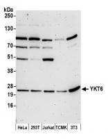 Detection of human and mouse YKT6 by wes
