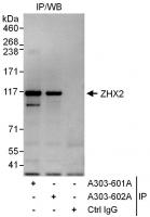 Detection of human ZHX2 by western blot 