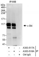 Detection of human c-Ski by western blot