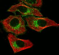 HeLa cells stained with mouse anti-tubul
