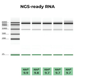 Smooth scaling of RNA extraction for high quality and throughput
