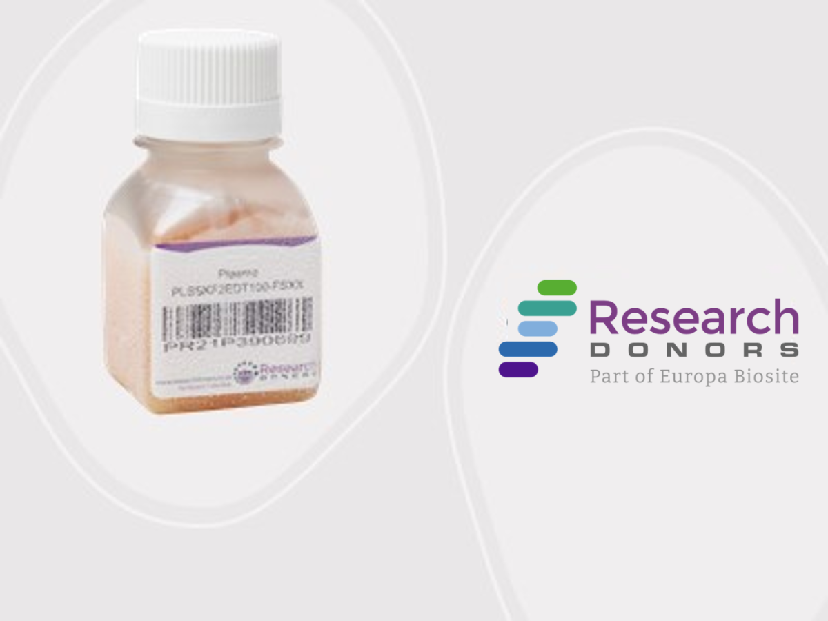 Search our frozen plasma stock inventory