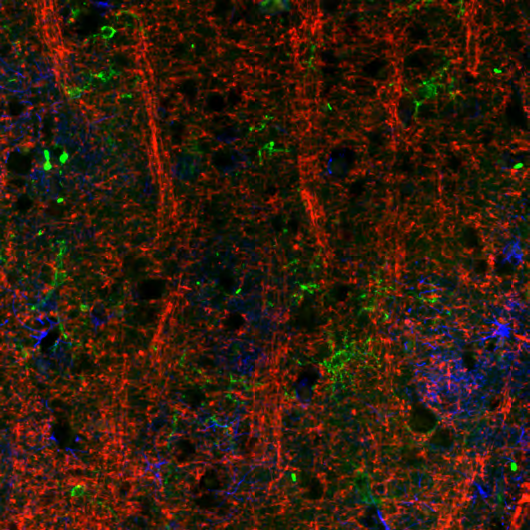Anti-P2RY12 (HPA014518) shows microglial cells in green. Anti-GFAP(AMAb91033) shows astrocytes in blue. Anti-MBP (AMAb91062) shows myelinated processes in red in Alzheimer’s disease cerebral cortex.