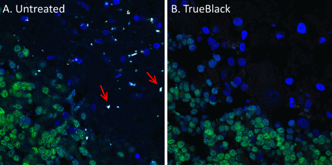 TrueBlack Lipofuscin Autofluorescence Quencher