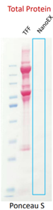 removal of free protein compared with TFF