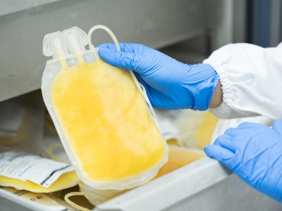 Blog: cryopreservation for optimising PBMC storage