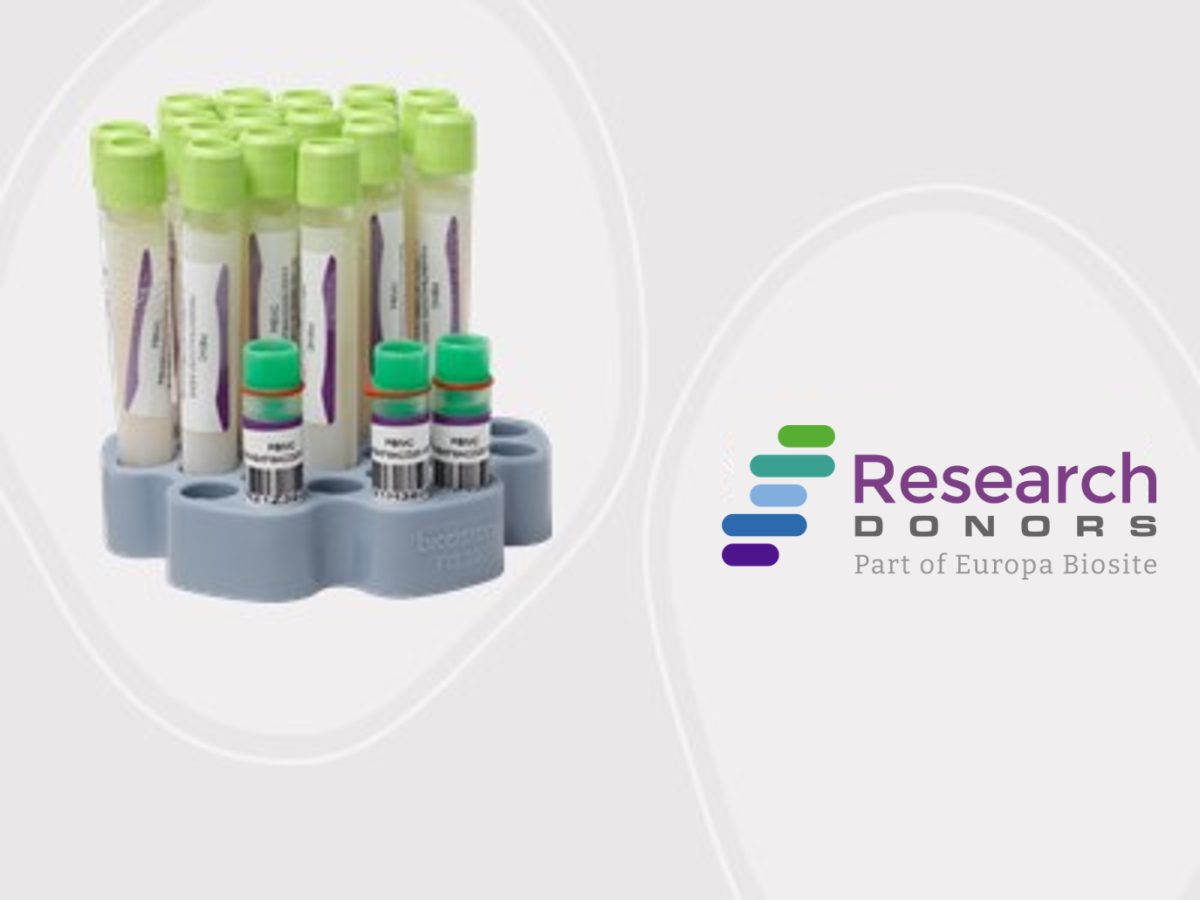 Search our frozen stock PBMC inventory
