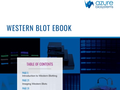 Download: Western blotting guidebook