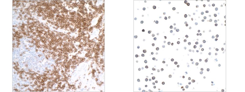 Detection of human CD27 in FFPE tonsil by IHC