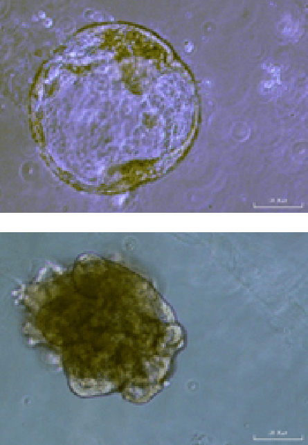 Gastric organoids (bright field) at day 7 and after splitting on day 22 expanding from small cysts that expand to bigger spheres