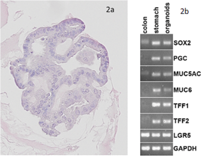 HE staining of Gastric organoids (2a) showing single layer of epithelia cells composed by the different cell types found in the stomach as seen in the PCR results (2b): expression of gastric mucins MUC5AC and MUC6, trefoil factors and pepsinogen, for instance. There are also stem cells markers like Lgr5 and Sox2.