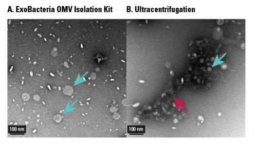ExoBacteria OMV Isolation Kit Is A Better Way To Isolate OMVs