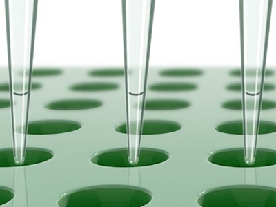 Discover more about our Lipoprotein profiling services
