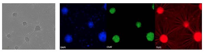 Phenotypic characterisation of axoCells