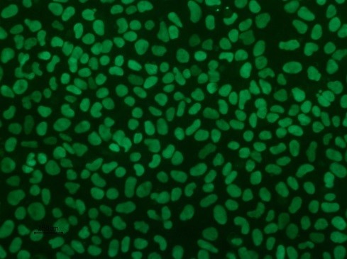 Cells cultured in Pluripro