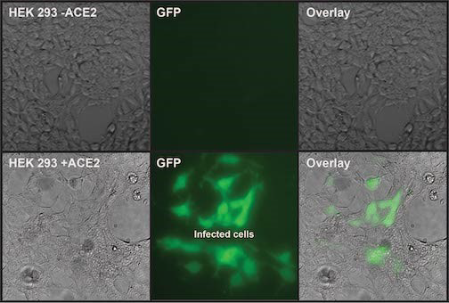 pPACK-SPIKE pseudovirus particles efficiently infect ACE2 overexpression cells
