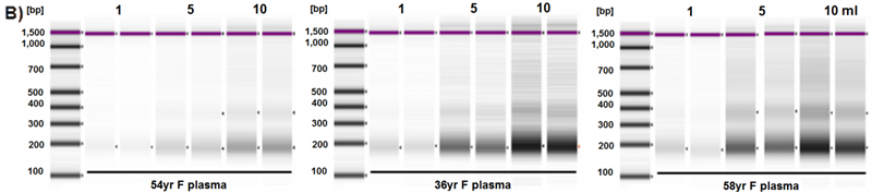 Quick-cfDNA serum and plasma