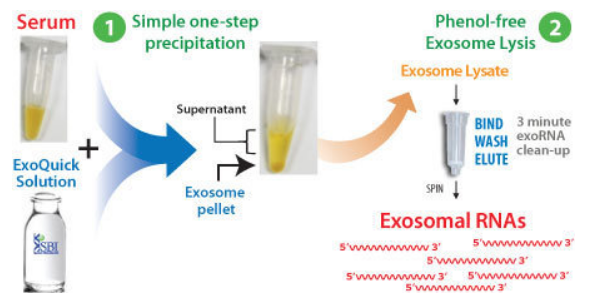 SeraMir: Isolate serum exosomes and purify exoRNAs