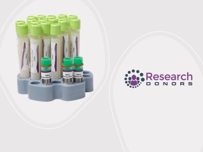 Research Donors: High viability PBMCs whenever your research demands