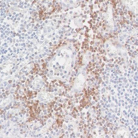 T-cell marker lymph node