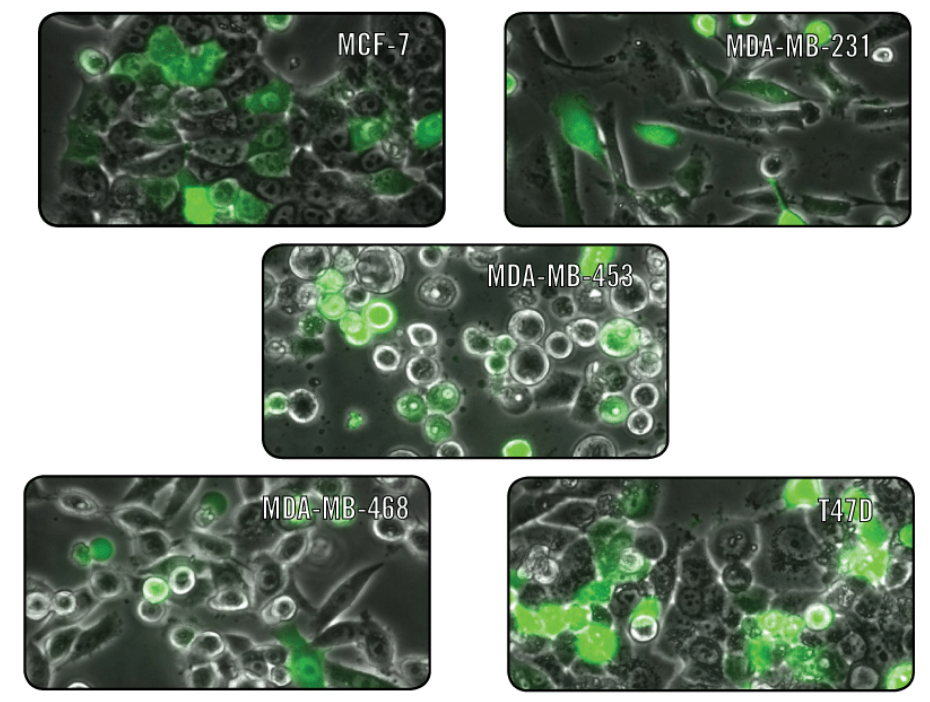 High Efficiency Delivery of Plasmid DNA in Breast Cancer Cell Types